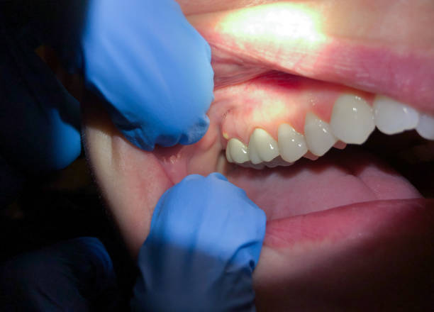 Best Emergency Cosmetic Dentistry in Ovid, MI